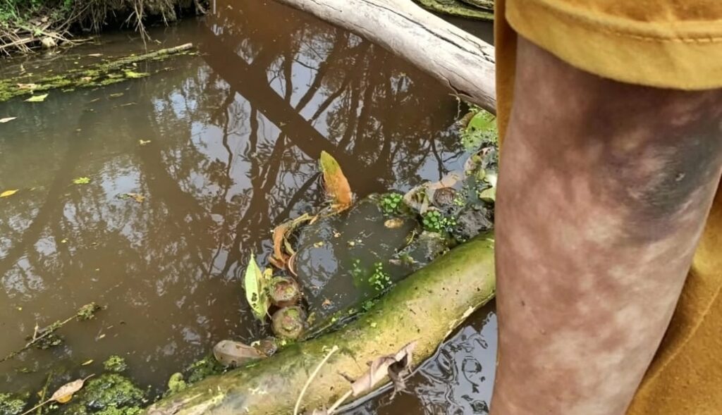 Warga Alami Gatal-Gatal, Dugaan Limbah PT MPL Cemari Sungai Nanga Gonis